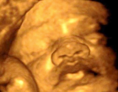 3d ultrasound pictures. 4D Ultrasound, 3D Ultrasound,